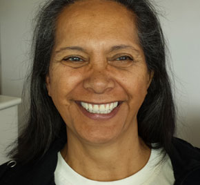 Ugie Moodley, Clinical Dental Technologist